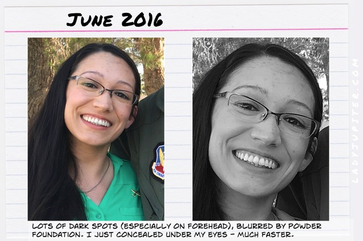 This is my post-charcoal&honey mask. Improvements? Yes, but I still hid under a sheer foundation.